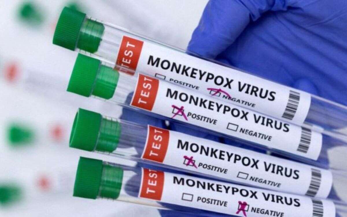 Monkeypox virus 1
