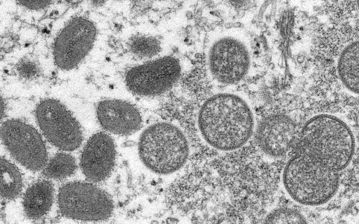 virus símico 1
