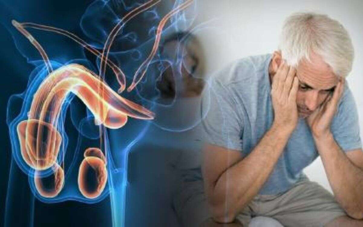 Disfunción erectil 1